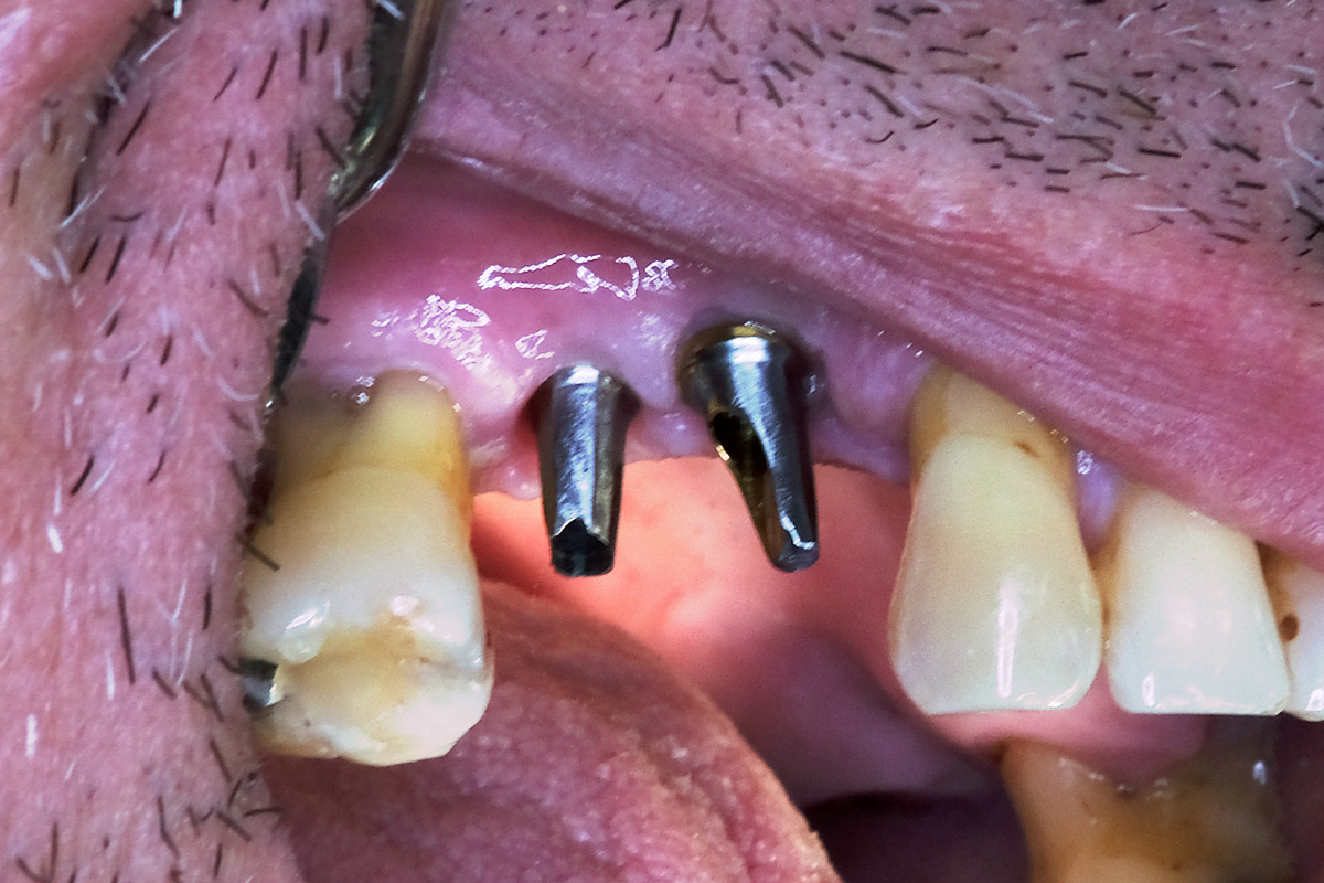 ΣΤΕΦΑΝΕΣΕΜΦΥΤΠΡΙΝ